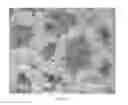Fig. 04 - POROUS SURFACE LAYERS WITH INCREASED SURFACE ROUGHNESS AND IMPLANTS INCORPORATING THE SAME