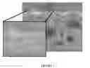 Fig. 05 - POROUS SURFACE LAYERS WITH INCREASED SURFACE ROUGHNESS AND IMPLANTS INCORPORATING THE SAME