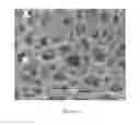 Fig. 07 - POROUS SURFACE LAYERS WITH INCREASED SURFACE ROUGHNESS AND IMPLANTS INCORPORATING THE SAME