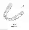 Fig. 02 - METHODS FOR FORMING PROGRESSIVE ALIGNERS