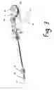 Fig. 04 - CABLE SAW SYSTEM