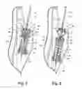 Fig. 06 - Laundry treating appliance suspension system