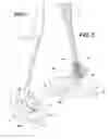 Fig. 02 - LID REMOVAL TOOL