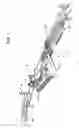 Fig. 02 - Ballast removal process