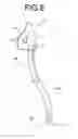 Fig. 09 - Gas mist inhaler