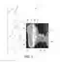 Fig. 02 - MASK AND METHOD FOR DELIVERING A THERAPEUTIC BREATHABLE SUBSTANCE