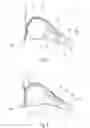 Fig. 03 - BREATHING ASSISTANCE DEVICE