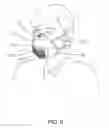 Fig. 06 - Mask