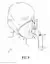 Fig. 06 - Respiratory interface device with flexible cover