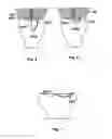 Fig. 04 - Intrauterine device string