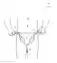 Fig. 01 - FULL MALE PROTECTION PROPHYLACTIC SYSTEMS