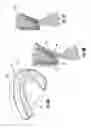 Fig. 04 - Dental guard with temporary forming tray