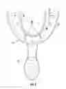 Fig. 05 - Dental guard with temporary forming tray