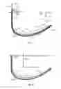 Fig. 07 - Methods for heating with slots in hydrocarbon formations