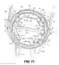 Fig. 10 - DCM circle shoe having angled wear insert