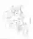 Fig. 05 - BRAKE CALIPER
