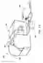 Fig. 18 - Firearm Lock and Rapid Actuation Unit