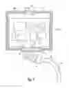 Fig. 02 - Pressure-relief valve of a housing for an electrical/electronic unit