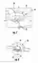 Fig. 05 - Metered dispensing system with nested boat fitment