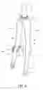 Fig. 06 - Bicycle damping system