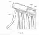 Fig. 92 - Seating structure and methods for the use thereof