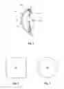Fig. 02 - Power System Implantable in Eye