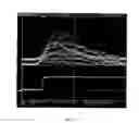 Fig. 18 - X-Ray and Gamma Ray Detector Readout Sytem