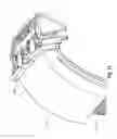 Fig. 14 - Tracking device incorporating enhanced security mounting strap