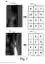 Fig. 08 - Systems and methods for text input for touch-typable devices
