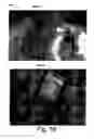 Fig. 17 - Systems and methods for text input for touch-typable devices
