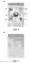 Fig. 04 - DEVICE AND METHOD FOR GESTURAL OPERATION OF CONTEXT MENUS ON A TOUCH-SENSITIVE DISPLAY