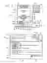 Fig. 04 - Ventilator breath display and graphic interface