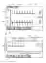 Fig. 09 - Ventilator breath display and graphic interface