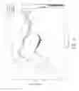 Fig. 06 - Active audio noise cancelling