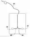 Fig. 01 - PRENATAL SOUND DELIVERY SYSTEM