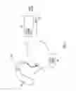 Fig. 02 - Range control for wireless hearing assistance device systems