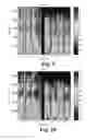 Fig. 06 - Stability improvements in hearing aids