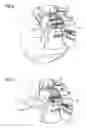 Fig. 07 - Hearing aid with audio shoe