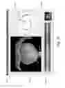 Fig. 16 - Identifying aorta exit points from imaging data