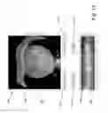 Fig. 19 - Identifying aorta exit points from imaging data