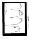 Fig. 12 - Motion compensation for medical imaging and associated systems and methods