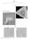Fig. 05 - Image quality assessment including comparison of overlapped margins