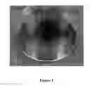 Fig. 03 - Sintered bush