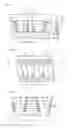 Fig. 02 - ROLLER BEARING, MAIN SHAFT SUPPORT STRUCTURE OF WIND POWER GENERATOR, AND METHOD FOR ADJUSTING CIRCUMFERENTIAL CLEARANCE BETWEEN RETAINER SEGMENTS OF ROLLER BEARING