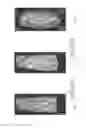 Fig. 08 - Methods For Improving Skin Quality