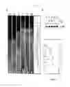 Fig. 02 - Composition comprising expression or activity inhibitors of ninjurin1 for the prevention and treatment of inflammatory disease