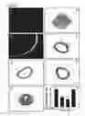 Fig. 06 - Circular dumbbell decoy oligodeoxynucleotides (CDODN) containing DNA bindings sites of transcription