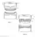 Fig. 02 - Prefabricated composite layers for duplication of tooth structure and mucosal tissue