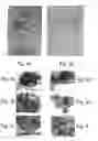 Fig. 03 - Polynucleotide constructs, pharmaceutical compositions and methods for targeted downregulation of angiogenesis and anticancer therapy