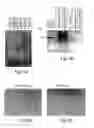 Fig. 05 - Polynucleotide constructs, pharmaceutical compositions and methods for targeted downregulation of angiogenesis and anticancer therapy